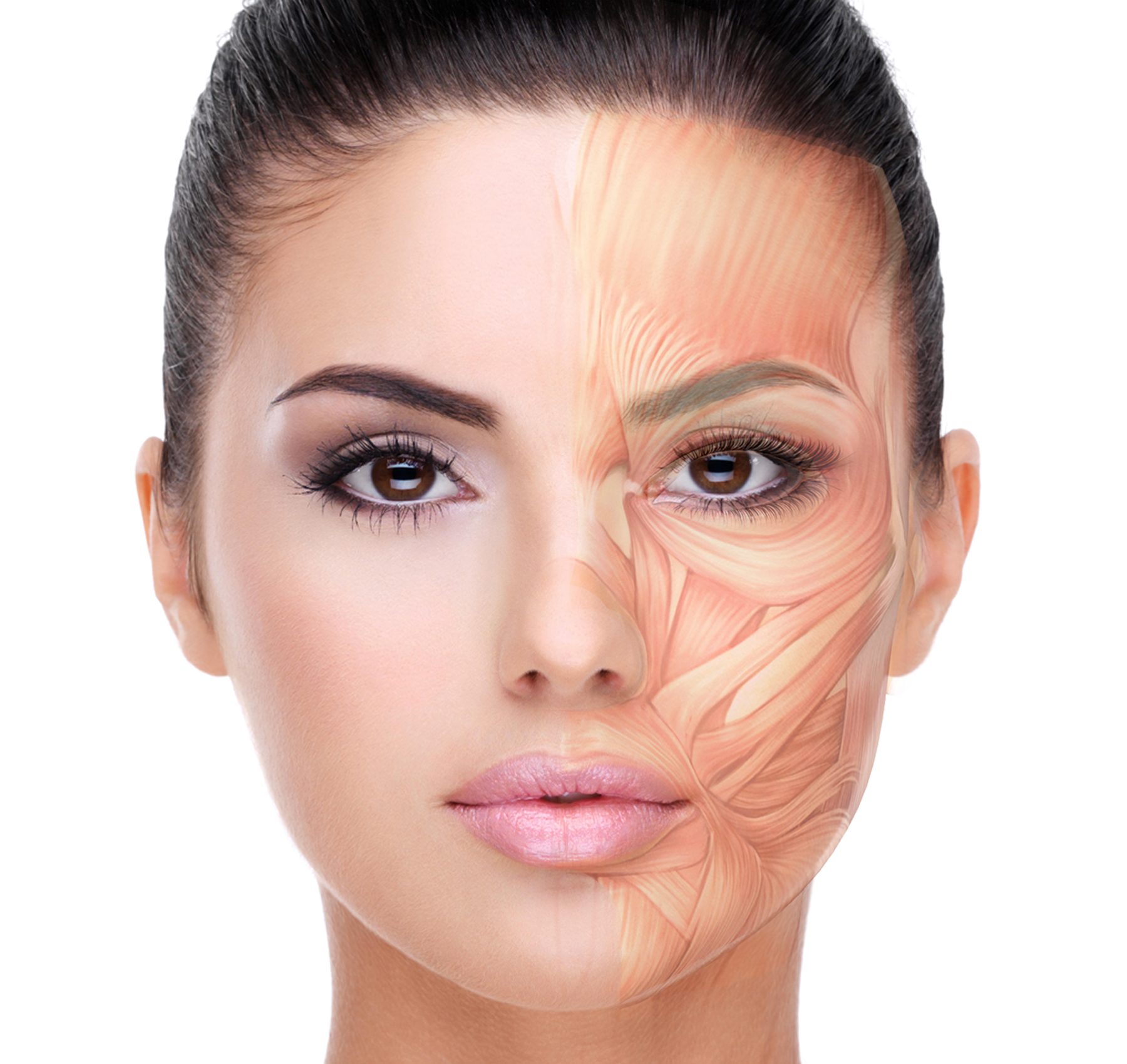 Botox for TMJ and migraines